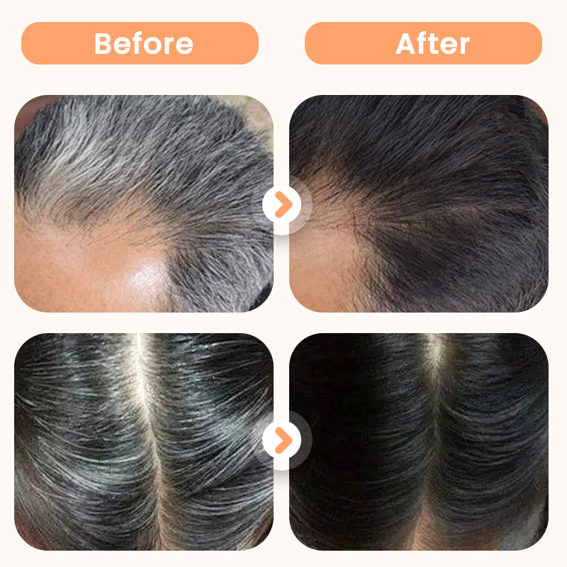 🌿 ¡COMPRA 2 LLEVA 3! ✨ Tinte Capilar con Extractos Vegetales - Cobertura Natural de Canas sin Amoníaco, Aporta Brillo y Suavidad al Cabello 💇♀️🧴