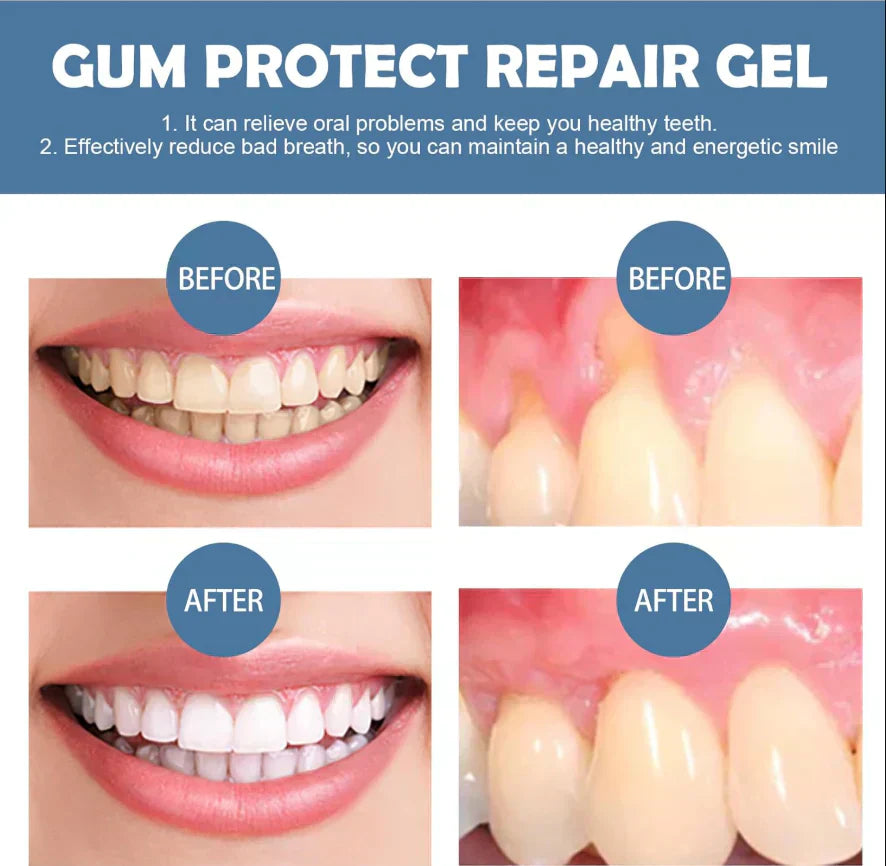 🔥 ¡50% DESCUENTO! 🌿 Gel para el cuidado de las encías con extractos de hierbas naturales | Cuidado bucal diario 🦷