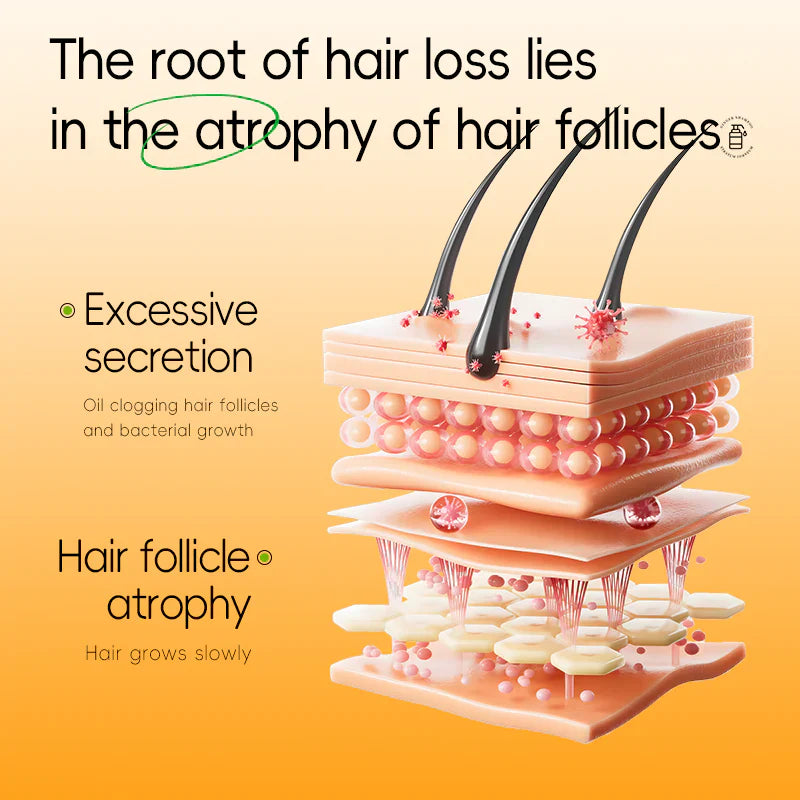 Champú Anticaída – ¡Fortalece Raíces, Recupera tu Melena! Dile adiós a la caída y hola a un cabello más fuerte y abundante. 🌿💪
