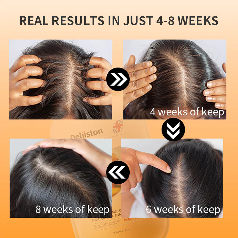 Champú Anticaída – ¡Fortalece Raíces, Recupera tu Melena! Dile adiós a la caída y hola a un cabello más fuerte y abundante. 🌿💪