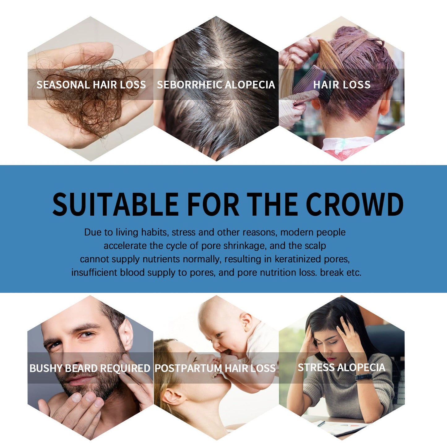 🌿EAST MOON Minoxi Roll-On Tratamiento Capilar| Compra 1, Lleva 1 Gratis 🔥