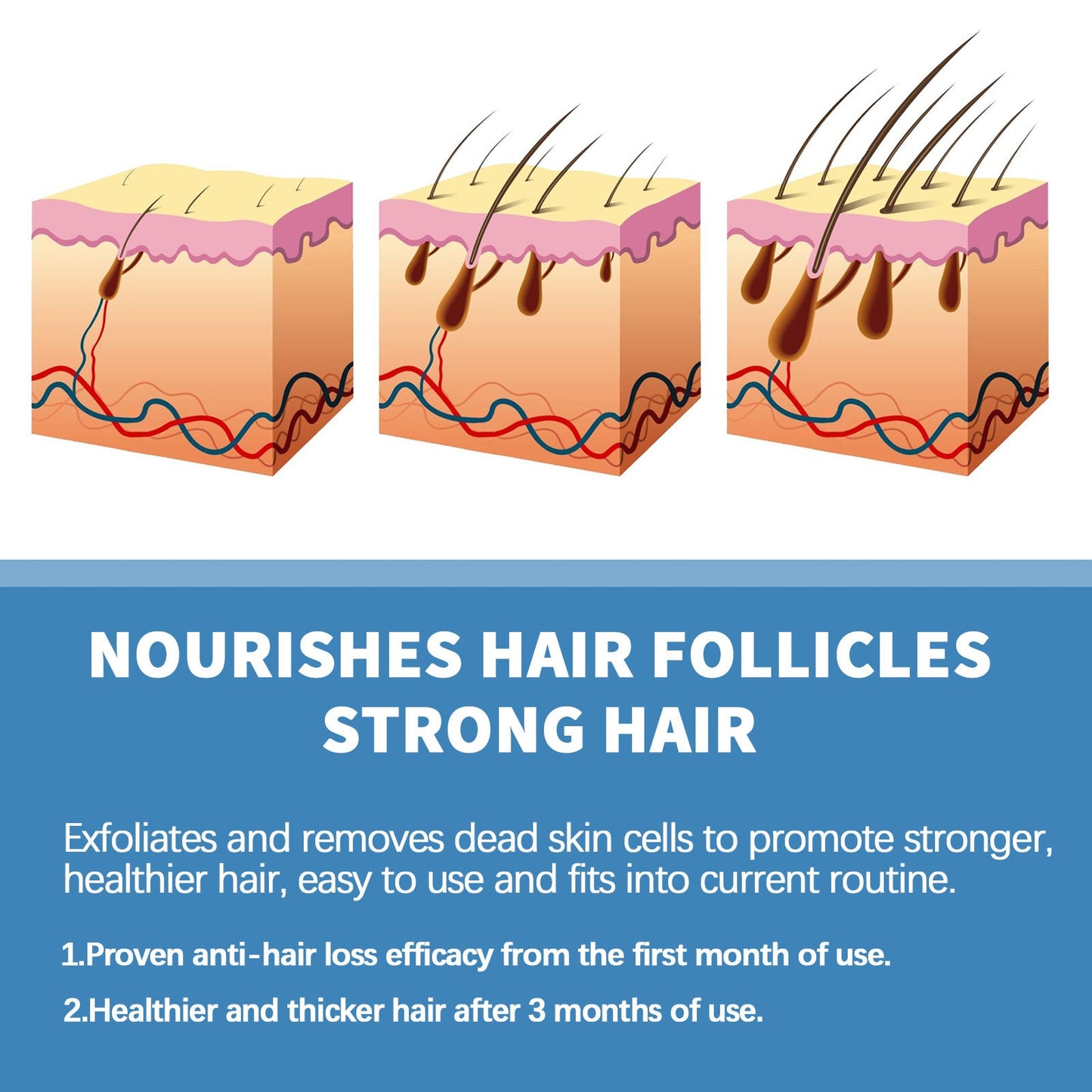 🌿EAST MOON Minoxi Roll-On Tratamiento Capilar| Compra 1, Lleva 1 Gratis 🔥