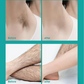 🔥Crema depilatoria corporal sin dolor para hombres y mujeres- Agradable para la piel de todas las zonas🌿