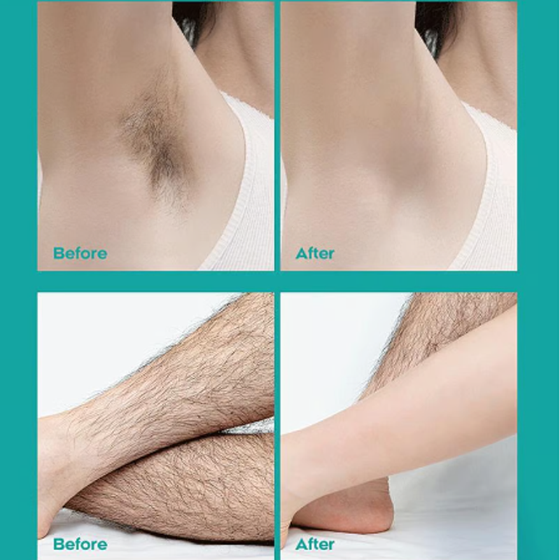 🔥Crema depilatoria corporal sin dolor para hombres y mujeres- Agradable para la piel de todas las zonas🌿