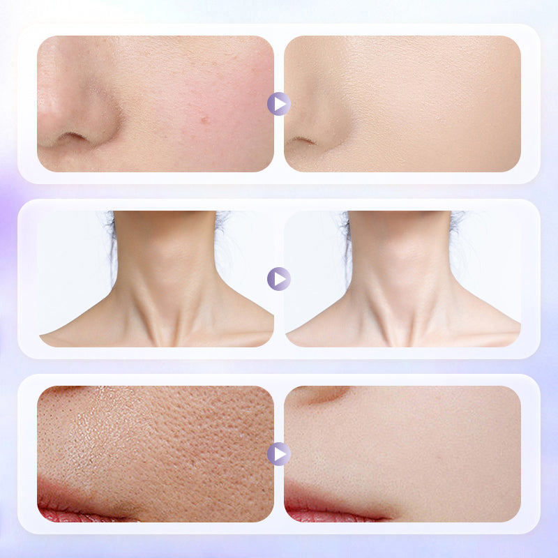 Crema Facial Aclaradora e Iluminadora de Duradero Efecto y Ligera