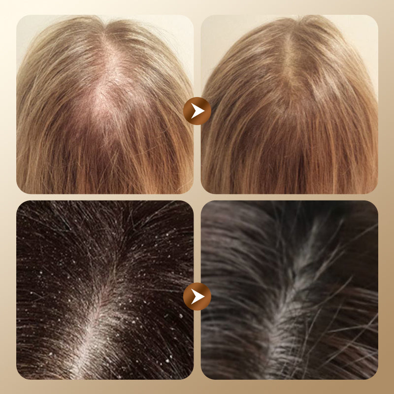 🌿 Champú de Hierbas para Prevenir la Caída y Promover el Crecimiento del Cabello