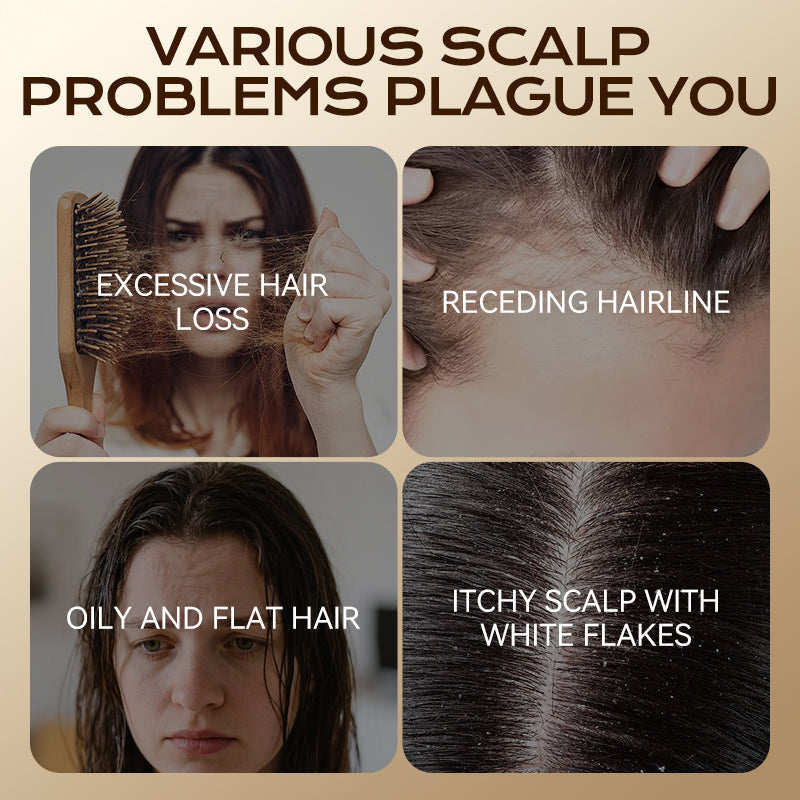 🌿 Champú de Hierbas para Prevenir la Caída y Promover el Crecimiento del Cabello