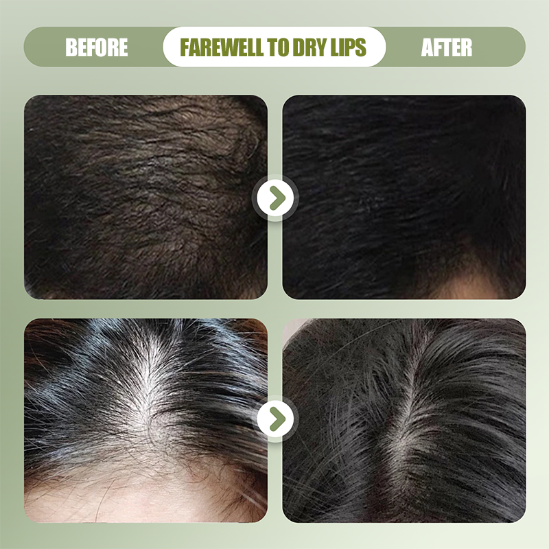 🌿Champú Sólido Natural para Fortalecer el Cabello