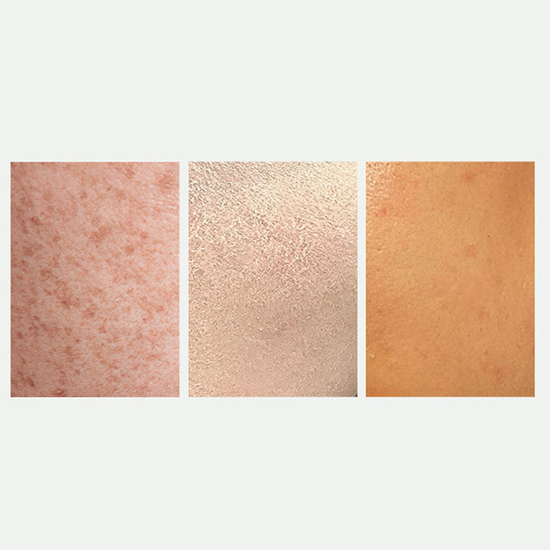 Spray blanqueador y corrector de manchas para una piel radiante|Compra 2 y Lleva 1 Gratis💗