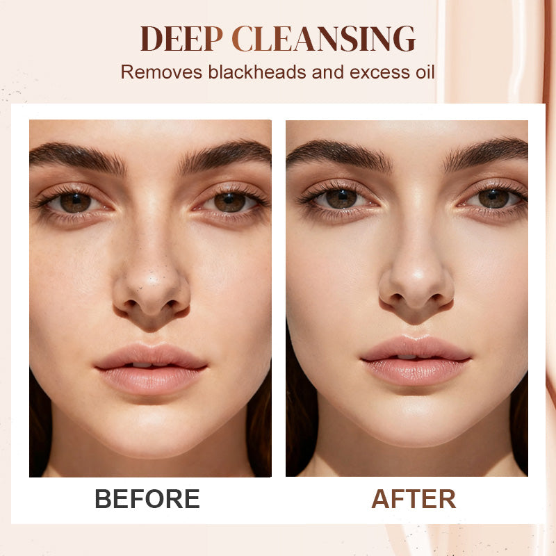 Gel Eliminador de Puntos Negros con Aloe Vera