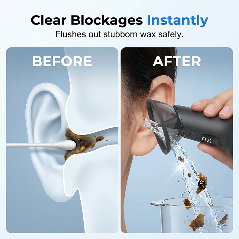 Limpiador de cerumen auricular portátil – Enjuague por agua pulsada