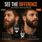 ✨ Aceite esencial para el cuidado de la barba – absorción rápida, no graso, nutre la piel y la barba 🌿